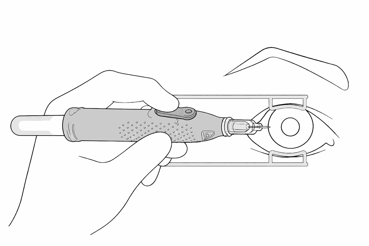 Illustration of the OcuTap device collecting ocular fluid with one hand